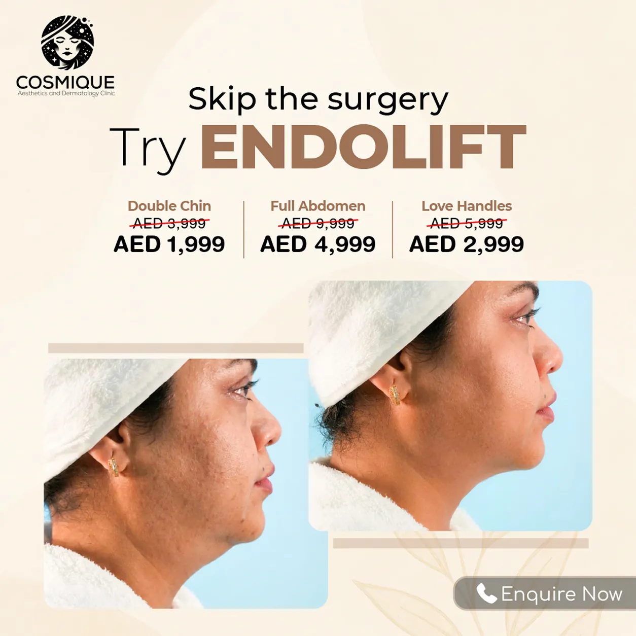 endolift August-06 1